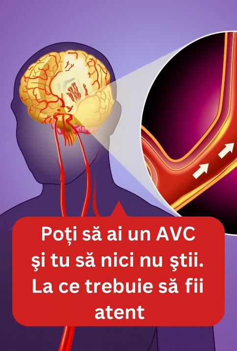 AVC-ul tăcut: cum îți poate da semne fără să știi